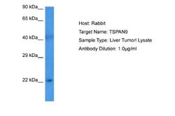 TSPAN9 Antibody, Novus Biologicals 100 &mu;L; Unconjugated:Antibodies,
